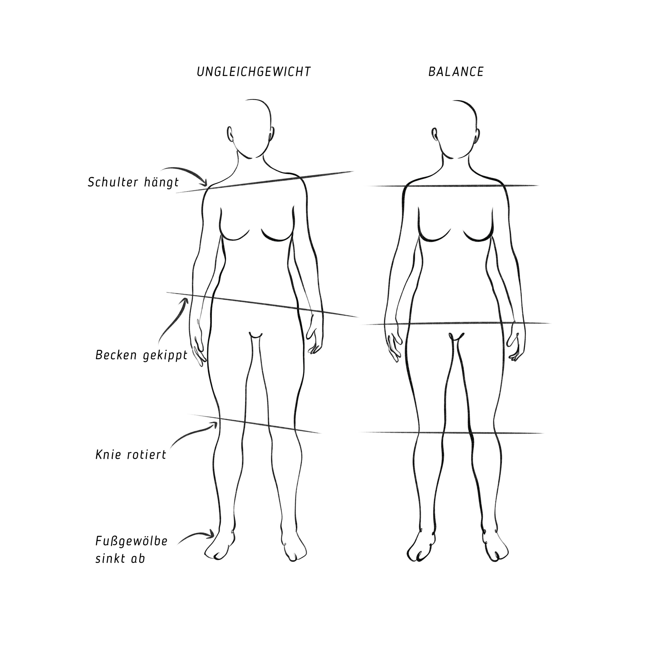 Abbildung, die zwei menschliche Figuren vergleicht. Die linke Figur mit der Aufschrift „UNGLEICHGEWICHT“ zeigt Probleme wie ungleiche Schultern und ein gekipptes Becken. Die rechte Figur mit der Aufschrift „BALANCE“ zeigt eine symmetrische Haltung und verkörpert die Vorteile der Rückentherapie Lübeck für Ausrichtung und Gleichgewicht.